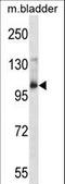 AP2 Associated Kinase 1 antibody, LS-C164282, Lifespan Biosciences, Western Blot image 