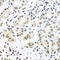 Insulin Like Growth Factor 2 MRNA Binding Protein 1 antibody, LS-C331506, Lifespan Biosciences, Immunohistochemistry paraffin image 