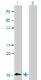 Hemoglobin Subunit Zeta antibody, H00003050-M01, Novus Biologicals, Western Blot image 