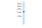 Zinc Finger Protein 2 antibody, PA5-41166, Invitrogen Antibodies, Western Blot image 