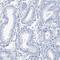 TSPY Like 6 antibody, PA5-57021, Invitrogen Antibodies, Immunohistochemistry paraffin image 