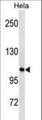 Unc-51 Like Autophagy Activating Kinase 1 antibody, LS-C157323, Lifespan Biosciences, Western Blot image 