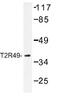 Taste 2 Receptor Member 20 antibody, AP01339PU-N, Origene, Western Blot image 