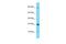 CFAP97 Domain Containing 1 antibody, A19570, Boster Biological Technology, Western Blot image 