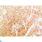 p65 antibody, LS-C813656, Lifespan Biosciences, Immunohistochemistry paraffin image 