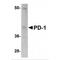 Programmed Cell Death 1 antibody, NBP1-75519, Novus Biologicals, Western Blot image 