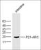 Actin Related Protein 2/3 Complex Subunit 3 antibody, orb185909, Biorbyt, Western Blot image 