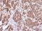 Actinin Alpha 4 antibody, LS-C186290, Lifespan Biosciences, Immunohistochemistry frozen image 