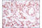 MET antibody, 8198S, Cell Signaling Technology, Immunohistochemistry paraffin image 