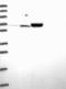 Trichohyalin Like 1 antibody, NBP1-80806, Novus Biologicals, Western Blot image 