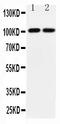 Glutamate receptor 3 antibody, PA2249, Boster Biological Technology, Western Blot image 