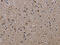 Integrin Subunit Beta 2 antibody, CSB-PA877324, Cusabio, Immunohistochemistry paraffin image 