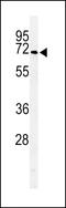 Arylsulfatase I antibody, LS-C156521, Lifespan Biosciences, Western Blot image 