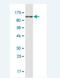 Actinin Alpha 4 antibody, H00000081-M06, Novus Biologicals, Western Blot image 