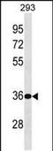 Biphenyl Hydrolase Like antibody, PA5-48978, Invitrogen Antibodies, Western Blot image 