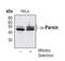 Parvin Alpha antibody, PA5-17185, Invitrogen Antibodies, Western Blot image 