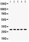 Aquaporin 1 (Colton Blood Group) antibody, PA5-78806, Invitrogen Antibodies, Western Blot image 