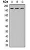 Epidermal Growth Factor Receptor Pathway Substrate 15 antibody, LS-C667786, Lifespan Biosciences, Western Blot image 