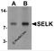 Selenoprotein K antibody, 6975, ProSci Inc, Western Blot image 