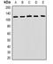 Membrane Bound Transcription Factor Peptidase, Site 1 antibody, orb378173, Biorbyt, Western Blot image 