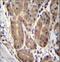 Abhydrolase Domain Containing 2 antibody, LS-C155870, Lifespan Biosciences, Immunohistochemistry paraffin image 