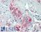 Anoctamin 1 antibody, LS-B14996, Lifespan Biosciences, Immunohistochemistry paraffin image 