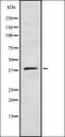 Zinc Finger DHHC-Type Containing 9 antibody, orb378271, Biorbyt, Western Blot image 