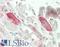 Annexin A7 antibody, LS-B13662, Lifespan Biosciences, Immunohistochemistry paraffin image 