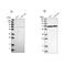 NPL4 Homolog, Ubiquitin Recognition Factor antibody, PA5-54749, Invitrogen Antibodies, Western Blot image 