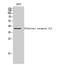 Olfactory Receptor Family 5 Subfamily I Member 1 antibody, A15527, Boster Biological Technology, Western Blot image 