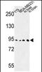 Dipeptidyl Peptidase Like 10 antibody, PA5-72610, Invitrogen Antibodies, Western Blot image 