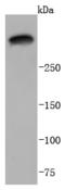 Laminin Subunit Alpha 3 antibody, A04194, Boster Biological Technology, Western Blot image 