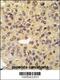 Menin 1 antibody, 62-893, ProSci, Immunohistochemistry paraffin image 