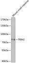 Tripartite Motif Containing 2 antibody, 15-519, ProSci, Western Blot image 