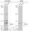 Fibroblast Growth Factor Receptor 4 antibody, GTX112935, GeneTex, Western Blot image 