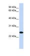 Ubiquitin Conjugating Enzyme E2 K antibody, orb330955, Biorbyt, Western Blot image 