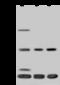 Translocase Of Inner Mitochondrial Membrane 17A antibody, 202614-T36, Sino Biological, Western Blot image 