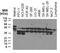 Nucleotide Binding Oligomerization Domain Containing 2 antibody, A00087, Boster Biological Technology, Western Blot image 