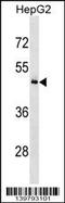 KH RNA Binding Domain Containing, Signal Transduction Associated 3 antibody, 60-293, ProSci, Western Blot image 