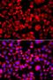 Eukaryotic Translation Initiation Factor 4 Gamma 1 antibody, LS-C349236, Lifespan Biosciences, Immunofluorescence image 