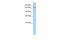 UDP-Glucose Glycoprotein Glucosyltransferase 2 antibody, A09788, Boster Biological Technology, Western Blot image 