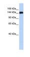 Gse1 Coiled-Coil Protein antibody, orb325959, Biorbyt, Western Blot image 