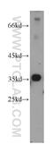 Metallophosphoesterase Domain Containing 1 antibody, 13677-1-AP, Proteintech Group, Western Blot image 