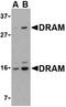 DNA Damage Regulated Autophagy Modulator 1 antibody, orb74798, Biorbyt, Western Blot image 