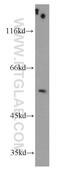 Tripartite Motif Containing 44 antibody, 11511-1-AP, Proteintech Group, Western Blot image 