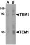 Endosialin antibody, TA306483, Origene, Western Blot image 