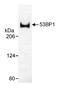 Tumor Protein P53 Binding Protein 1 antibody, NB100-305, Novus Biologicals, Western Blot image 