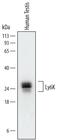 Lymphocyte Antigen 6 Family Member K antibody, PA5-47859, Invitrogen Antibodies, Western Blot image 