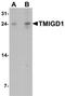 Transmembrane And Immunoglobulin Domain Containing 1 antibody, TA326694, Origene, Western Blot image 