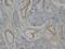 Collagen Type IV Alpha 1 Chain antibody, MA1030, Boster Biological Technology, Immunohistochemistry paraffin image 